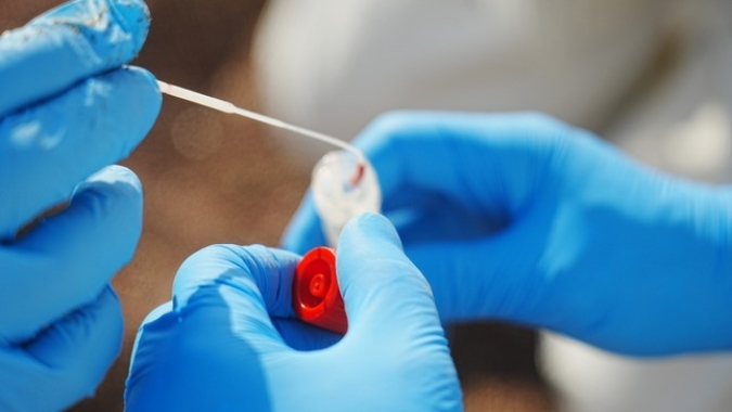 Governo do Espírito Santo reforça vigilância contra a influenza aviária